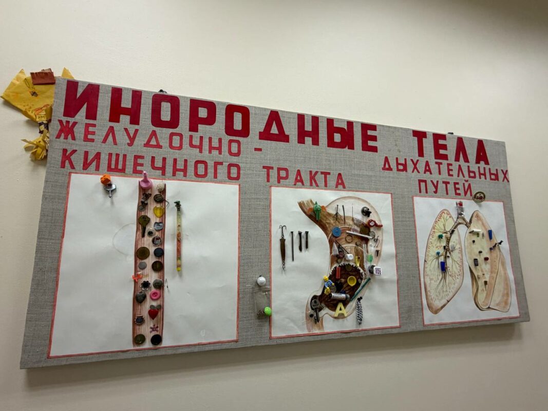 Юный вологжанин проглотил ключ от мотоцикла