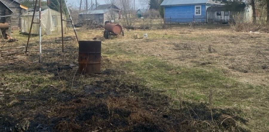 Вологжанин получил смертельные ожоги во время сжигания мусора