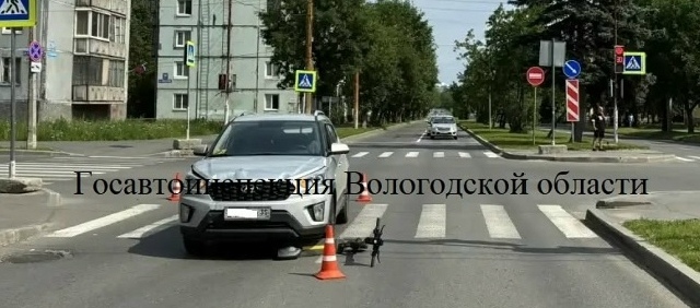 Вологжанин распорол грудь стеклом при падении с самоката